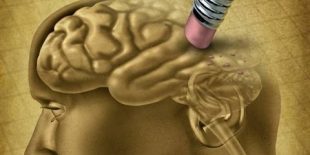 За больными Альцгеймером